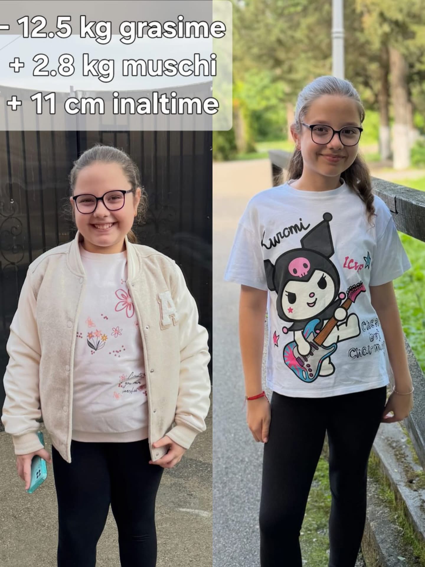 Before/after copil 11 ani, -12,5 kg grăsime + 11 cm înălțime