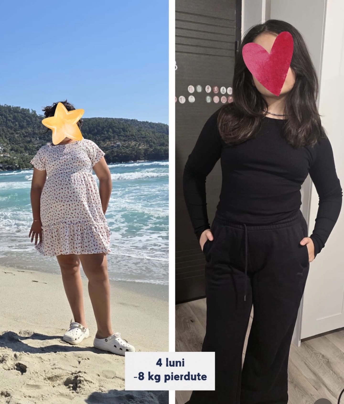 Before/after adolescentă, -8 kg în 4 luni